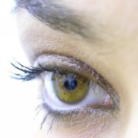 Sausās acs sindroms