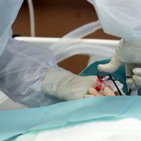 Pirmo reizi Latvijā veikta endoskopiska vairogdziedzera operācija