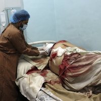 WSJ: Число жертв теракта в Кабуле превысило 200 человек