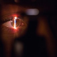 Ja lāzerkorekcija ir tik droša, kāpēc oftalmologi paši lieto brilles? Atbild optometriste