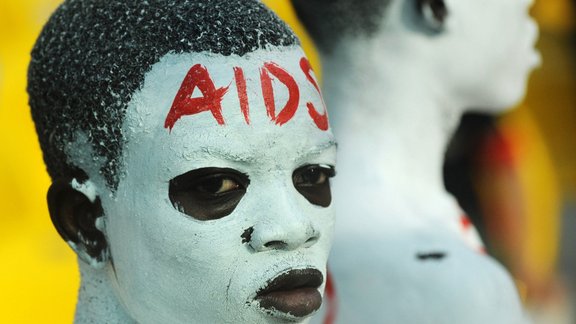 AIDS; HIV