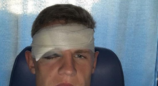 Защитник сборной Латвии получил неприятную травму