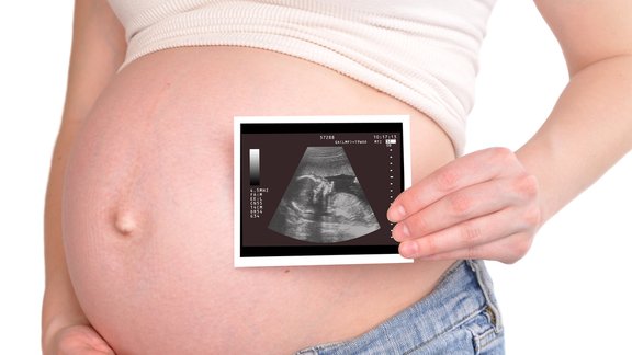 grūtniecība usg sonogrāfija vēders sieviete pregnancy stomach