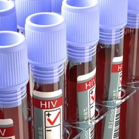 Ar jaunu metodi, iespējams, izdevies izārstēt HIV pacientu