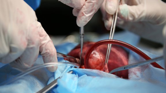 borščs zupa ēdiens transplantācija donori vakariņas 