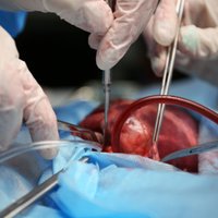 Latvijā trūkst orgānu donoru; aicina reģistrēties dzīvību glābšanai