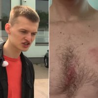 Latvijā studējošs ukrainis sūdzas par fizisku uzbrukumu autoservisā