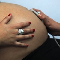 Госпитализирована беременная женщина, отравившаяся угарным газом