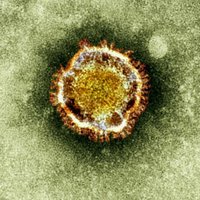No SARS līdzīga vīrusa Saūda Arābijā miruši pieci cilvēki