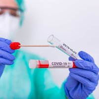 Turpmāk valsts apmaksātu Covid-19 testu varēs veikt tikai ar ārsta nosūtījumu