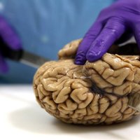 Itālijā modelē 17 000 gadu senas bērna smadzenes