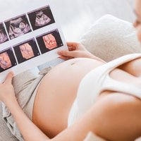 Ultrasonogrāfijas nozīme grūtniecības laikā