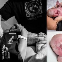 Patiesības mirkļi: pirmās sekundes pēc jaundzimušā ierašanās lielajā pasaulē