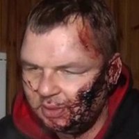 Украинская милиция: избитый Булатов тратил на себя деньги "Автомайдана"
