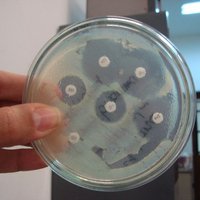 ВОЗ: миру угрожают непобедимые бактерии, от которых нет лекарств