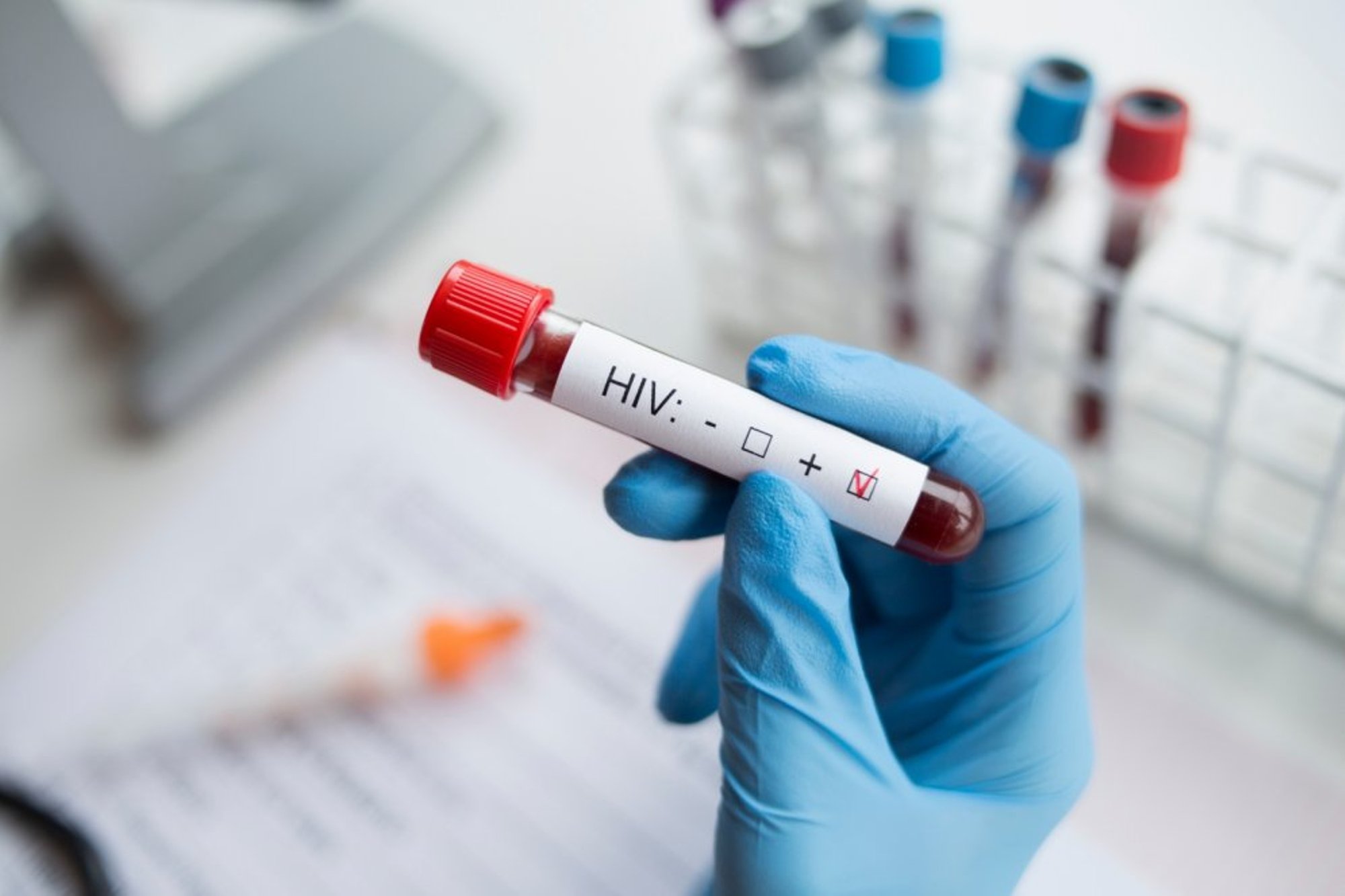 Bezmaksas, anonīmi, konfidenciāli – aicina pārbaudīt veselību un veikt HIV testu
