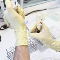 Минздрав планирует создать регистр больных гепатитом С