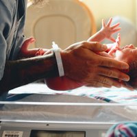 Biežākās dzemdību traumas jaundzimušajiem – atslēgas kaula lūzums un kefalohematomas