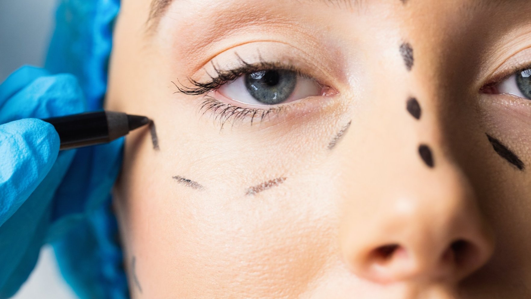 Elīna Didrihsone sola bezmaksas plastisko operāciju Turcijā – cik "dārgi" tas var izmaksāt laimētājam?