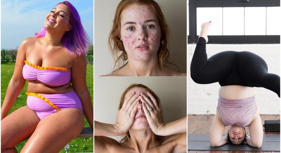 Вопреки стандартам красоты: истории шести женщин, которые без стеснения показывают свое тело в Instagram