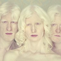 Ar albīnismu slimu cilvēku foto portreti