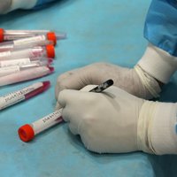 За сутки в Эстонии выявлено 524 новых случая коронавирусной инфекции, в Литве - 2109
