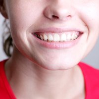 Топ-10 способов отбеливания зубов