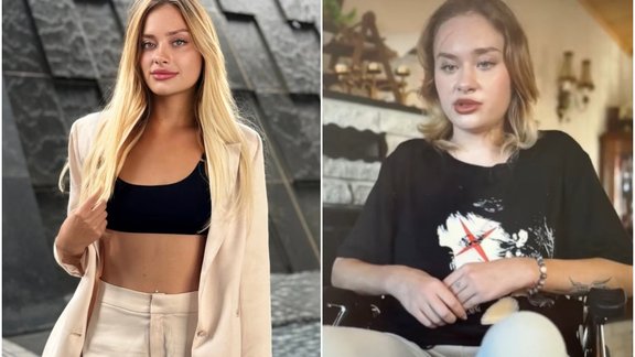 Dubaijas "šeihu ballītē" sakropļotā "OnlyFans" modele pirmo reizi stāsta notikušā detaļas