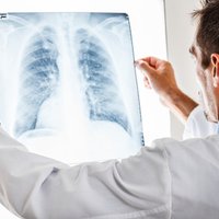 Plaušu bojājumi, kognitīvi traucējumi – Covid-19 sekas ieskicē rehabilitācijas centra priekšniece
