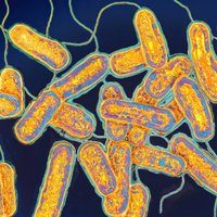 "Болезнь легионеров" в Риге: бактерии находят в многоквартирных домах