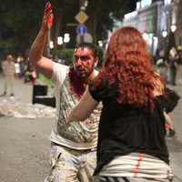 Число пострадавших во время протеста в Тбилиси выросло до 300 человек, двое лишились глаз