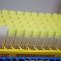 В Эстонии за сутки выявлено шесть новых случаев коронавируса, в Литве — 30