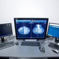 Austrumu slimnīcā uzstādītas divas jaunas krūts vēža diagnostisko izmeklējumu iekārtas