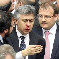 Kautiņš Turcijas parlamentā beidzas ar lauztu degunu un pirkstiem