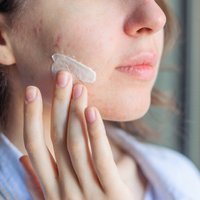 Netīras rokas un šmucīgas otas – kādas skaistumkopšanas kļūdas veicina aknes veidošanos