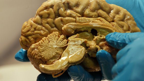 human brain smadzenes