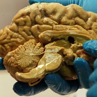 10 interesanti fakti par cilvēka smadzenēm
