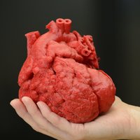 Slimu bērnu glābj ar 3D printeri izdrukāta sirds