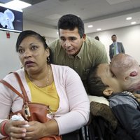 В Майами после удаления гигантской опухоли лица умер кубинский мальчик