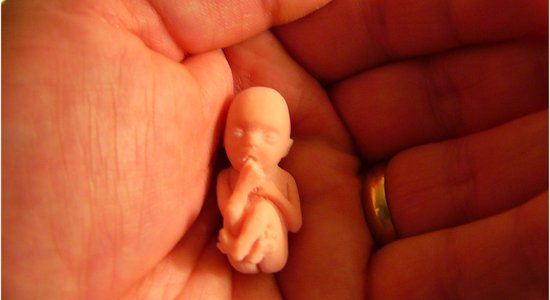 Papardes zieds и Фонд Сороса встревожены попытками ограничить аборты