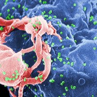 ASV zinātnieki sper pirmo soli ceļā uz nākotnes HIV vakcīnas radīšanu