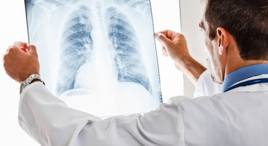 HOPS – plaušu slimība, kas piezogas nemanot