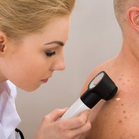 Pētījums: teju trešā daļa Latvijas iedzīvotāju nezina, kas ir melanoma