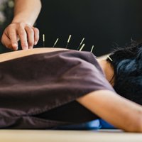 Akupunktūra – efektīva medicīniska procedūra vai izdomājums?