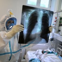 За сутки в Литве выявлены четыре новых случая коронавируса, в Эстонии - десять