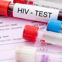 HIV nozīmē nāves spriedumu un citi mīti par biedējošo infekciju