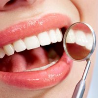 Pieci padomi baltākiem zobiem bez balināšanas