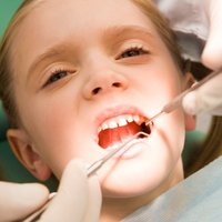 Bērniem līdz 15 gadiem zobus labos tikai ar baltajām plombēm; valsts apmaksās poligrāfijas un polisomnogrāfijas izmeklējumu