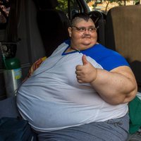 Foto: Pasaulē resnākajam vīrietim samazinās kuņģi