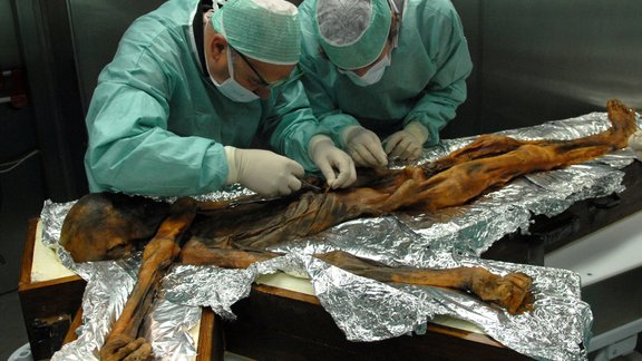 Ötzi the Iceman